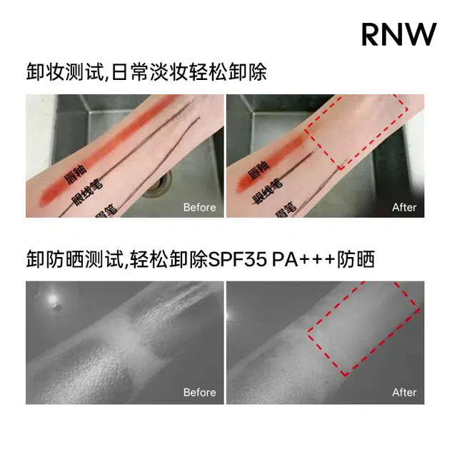 RNW 30ml