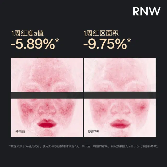 RNW 100g150g