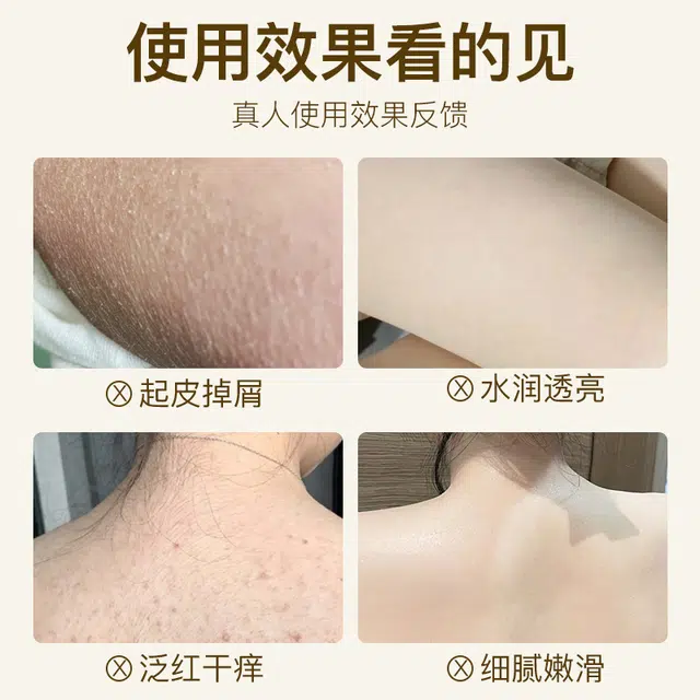 100ml
