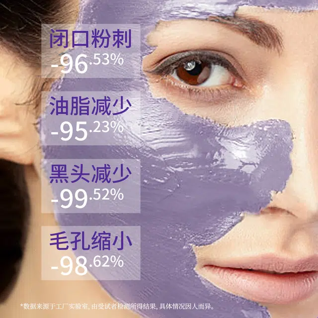 益特龙 青少年紫苏芳香保湿祛痘毛孔泥膜祛痘补水补水面膜 祛痘保湿补水 深层清洁温和不刺激去黑头净化肌肤清爽不油持久保湿