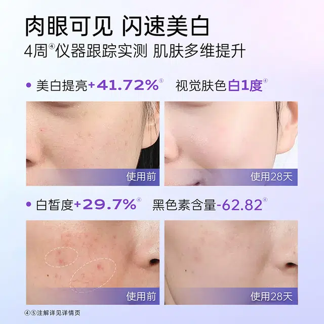 优理氏优理氏美白淡斑精华液 美白 多种肤质